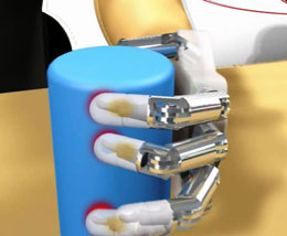 Toxunduğu şeyləri hiss edən bionik əl